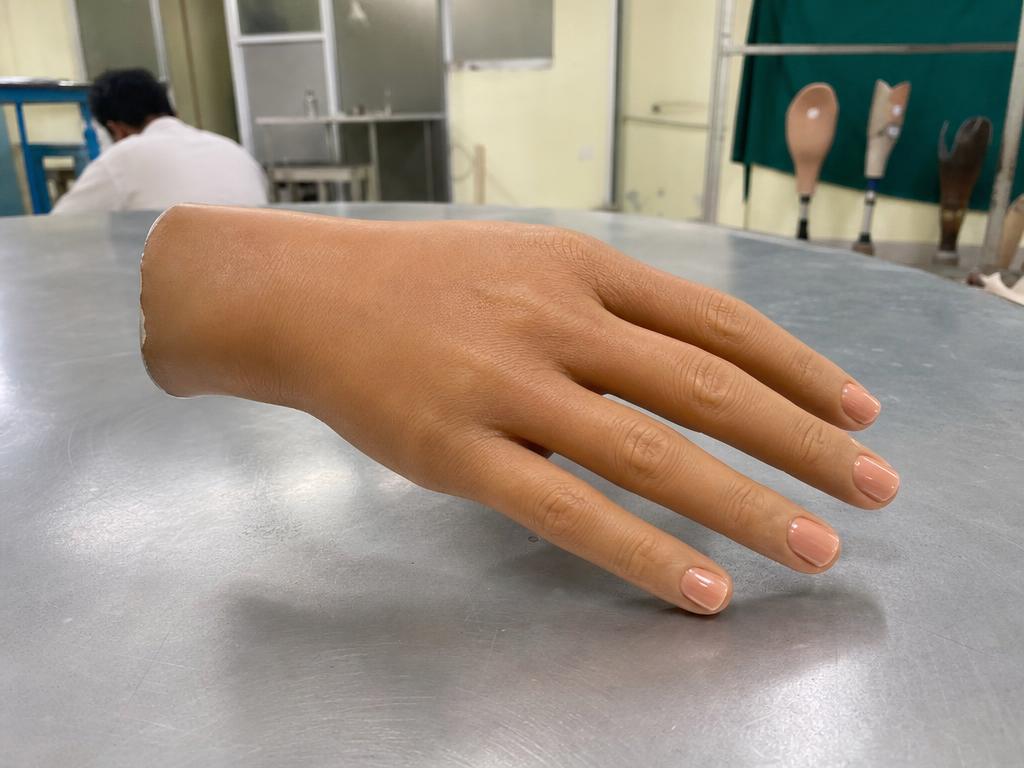 Lifelike cosmetic silicone hand prosthesis in the prosthetics workshop