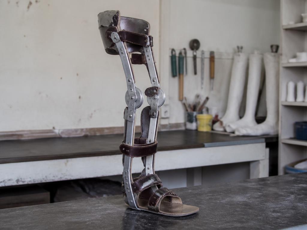 Knee Ankle Foot Orthosis (KAFO) long leg brace in the orthotics workshop